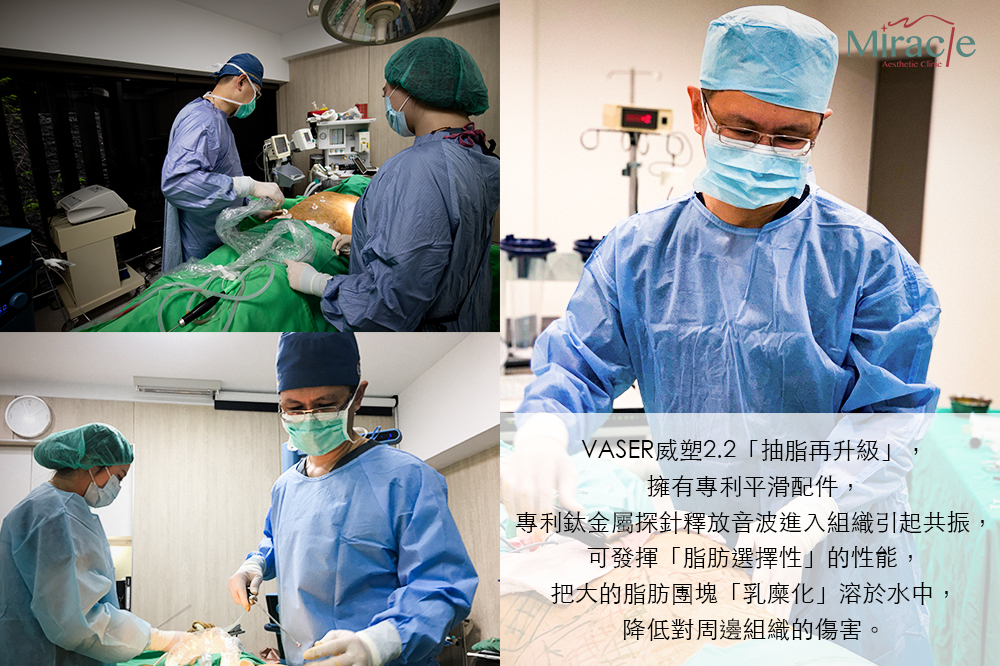 擁有專利平滑配件，可發揮脂肪選擇性的性能，把大的脂肪團塊乳糜化溶於水中，降低對周邊組織的傷害。