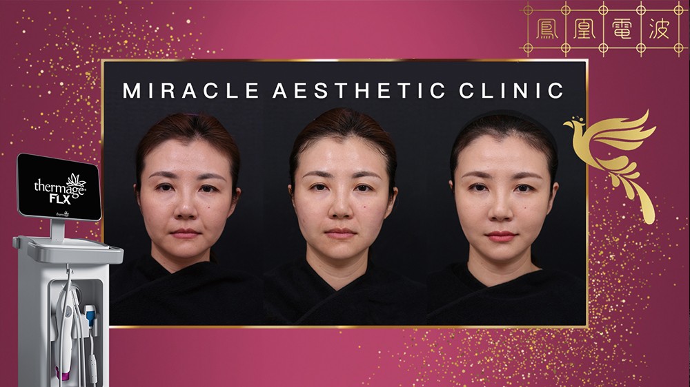 鳳凰電波FLX,面部緊實3D治療