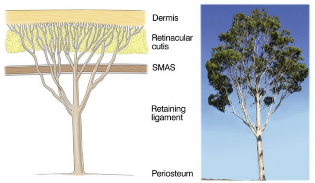 玻尿酸True Lift真性韌帶拉皮,臉型下垂拉提免動刀!