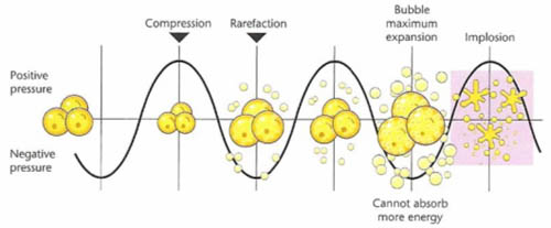 喬菲的超音波手臂抽脂心得|蝴蝶袖抽脂還我手臂緊緻線條