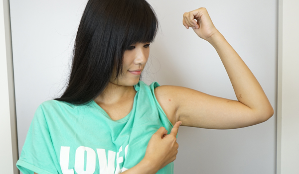 喬菲的超音波手臂抽脂心得|蝴蝶袖抽脂還我手臂緊緻線條