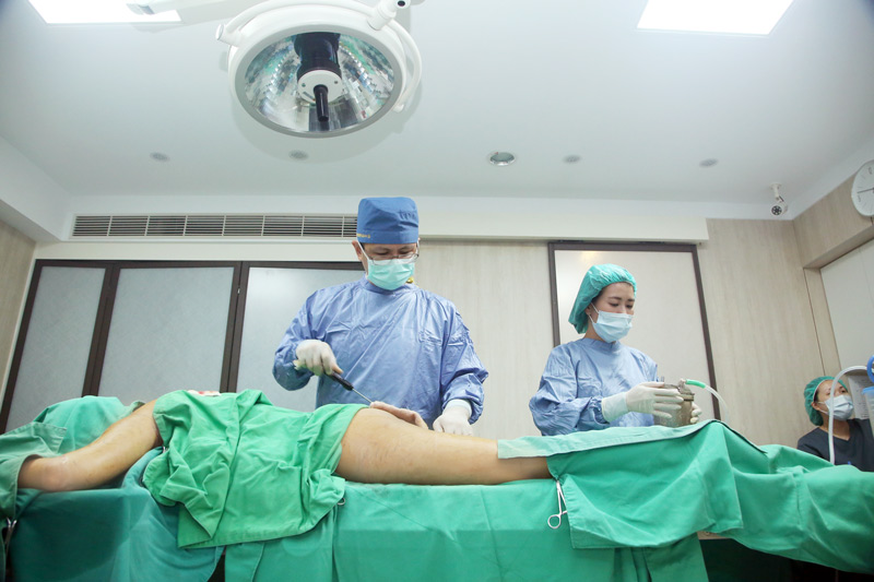 自體脂肪轉移豐胸隆乳:女孩大腿抽脂轉移勇敢蛻變