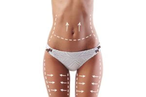 隔空減脂讓你輕鬆瘦,米秝琪帶你了解隔空減脂價格與手術重點